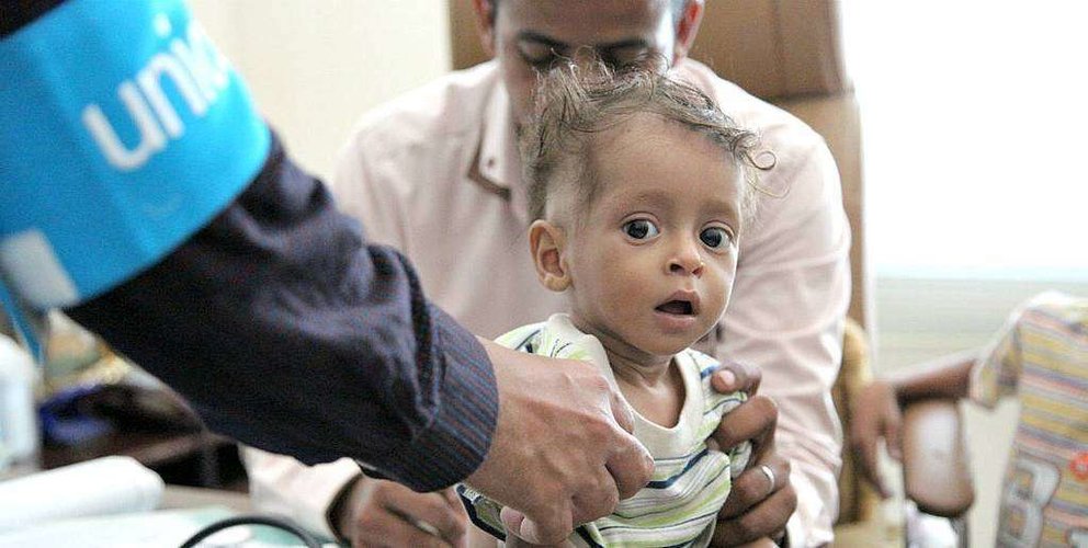 Personal de Unicef atiende a un niño en Yemen. (Unicef)