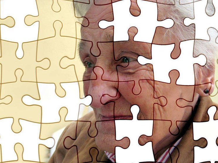El estudio abre la posibilidad de desarrollar nuevos modos para diagnosticar y curar el Alzheimer. (pxhere.com)