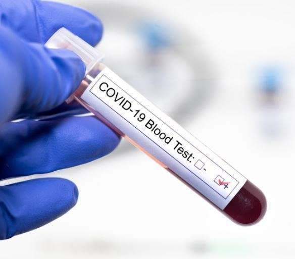 Un test de coronavirus Covid-19.