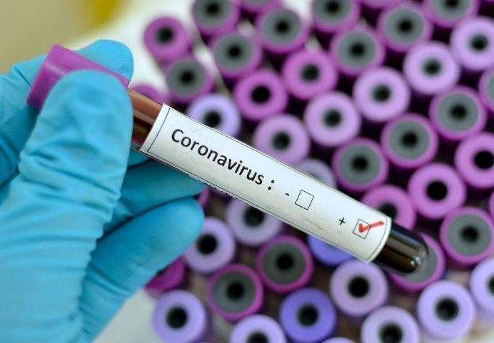 Test médico para detectar el coronavirus. (Fuente externa)