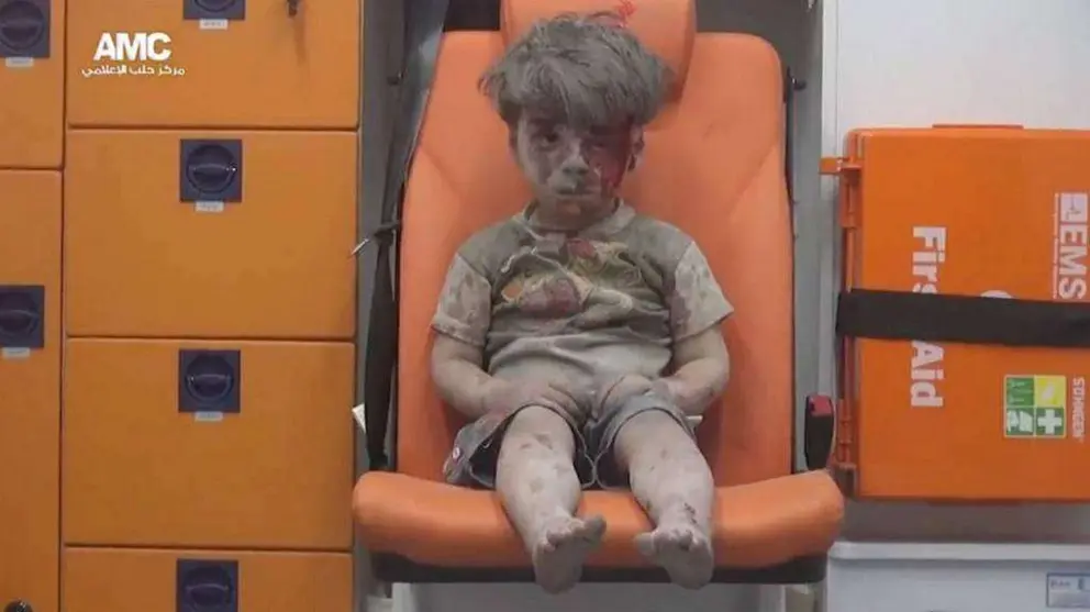 Omran aguardan en silencio a que lo atiendan de sus heridas. (Mahmoud Ruslan / Reuters)