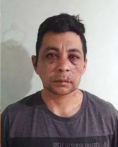El enfermero argentino tras ser golpeado por sus vecinos. (Twitter)