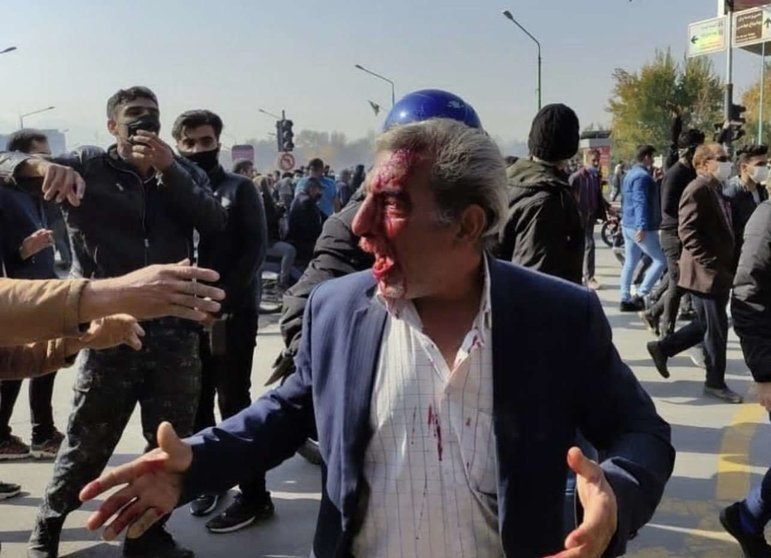 Un manifestante herido en Irán. (Twitter)