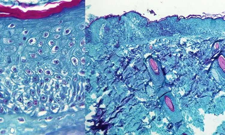 Una vista microscópica muestra el virus de la viruela del mono. (Fuente externa)