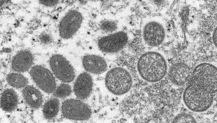 Una imagen de microscopía electrónica (EM) muestra partículas maduras del virus de la viruela del mono. (Fuente externa)