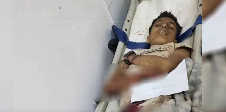 Uno de los niños heridos. (X)