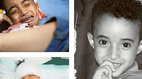 Fotos de Ahmad Al Basha del ni&ntilde;o yemen&iacute;.