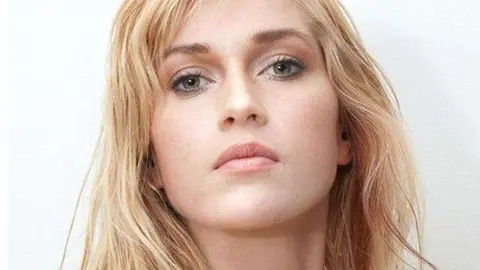 La modelo que gastó 120.000 dólares es cirugías.