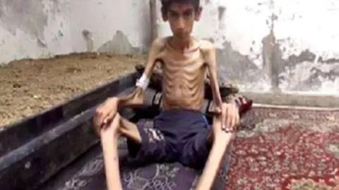 Las imágenes de sirios famélicos están dando la vuelta al mundo.