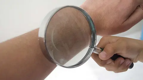 Examen de piel. (CBV)