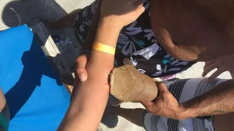 Imagen de la joven con el tiburón en el brazo.