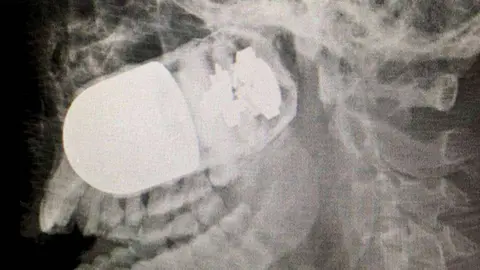 Imagen del artefacto en el rostro del soldado.