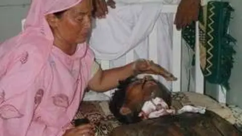 Un familiar cuida del hombre quemado con ácido en Paquistán. (Agencias)