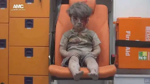 Omran aguardan en silencio a que lo atiendan de sus heridas. (Mahmoud Ruslan / Reuters)