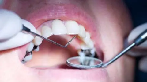 Paciente con odontología con metales.
