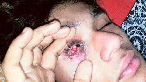 Imagen de Rizwan tras el accidente. (Tomada de Gulf News)