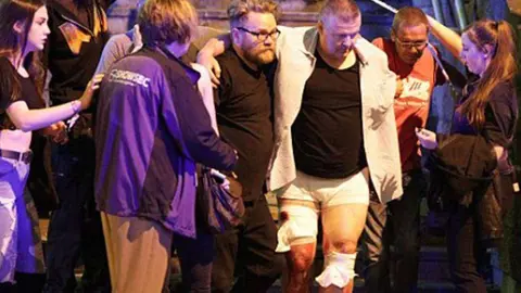 Uno de los heridos en el atentado ocurrido en Mánchester.