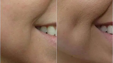 Sobre un 80 por ciento de clientes muestra una foto de una celebridad a su cirujano plástico.