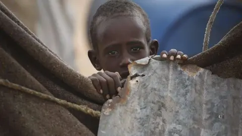 En la imagen de EFE, un niño en un campamento de refugiados en Somalia.