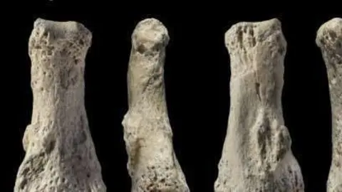 En la imagen de Reuters, el hueso encontrado desde distintos ángulos.
