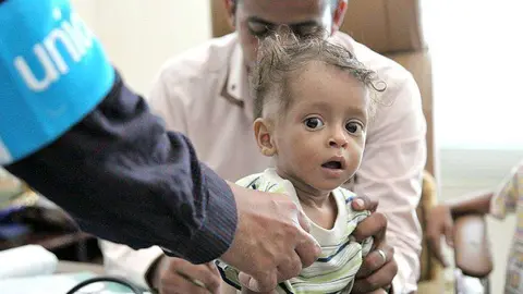 Personal de Unicef atiende a un niño en Yemen. (Unicef)