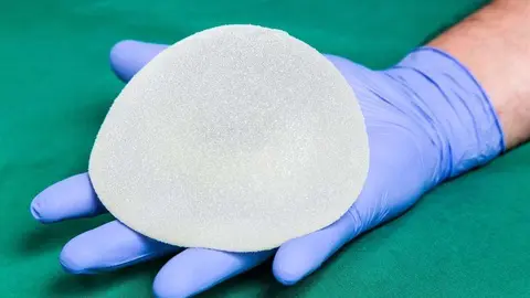 Una imagen de un implante mamario.