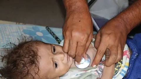 Niño yemení recibe ayuda sanitaria en la costa del Mar Rojo en Yemen. (WAM)