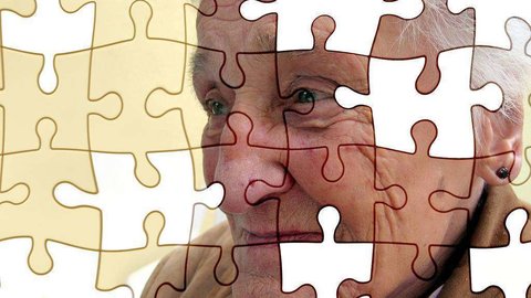 El estudio abre la posibilidad de desarrollar nuevos modos para diagnosticar y curar el Alzheimer. (pxhere.com)