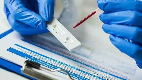 Un laboratorio de pruebas analíticas. (WAM)