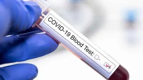 Un test de coronavirus Covid-19.