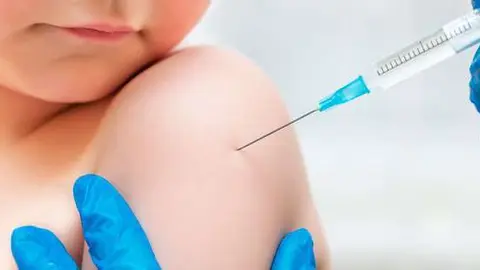 El virus del sarampión se ha propagado en los últimos años. (Fuente externa)