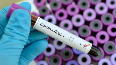 Test médico para detectar el coronavirus. (Fuente externa)