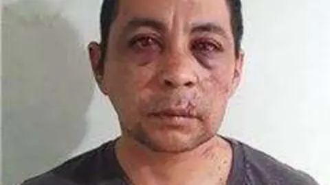 El enfermero argentino tras ser golpeado por sus vecinos. (Twitter)