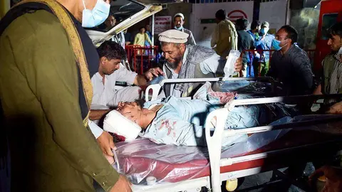 Herido es atendido tras las explosiones de este jueves en Kabul. (@MundoEConflicto)
