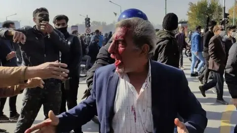 Un manifestante herido en Irán. (Twitter)