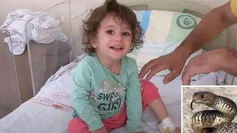 La niña turca que fue mordida por la serpiente. (Al Arabiya)
