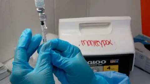 La viruela del mono se ha considerado una emergencia mundial. (Fuente externa)