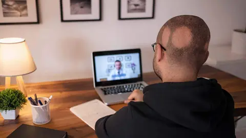 Una imagen de un paciente con alopecia. (WAM)