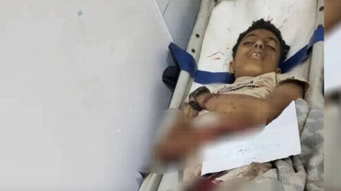 Uno de los niños heridos. (X)