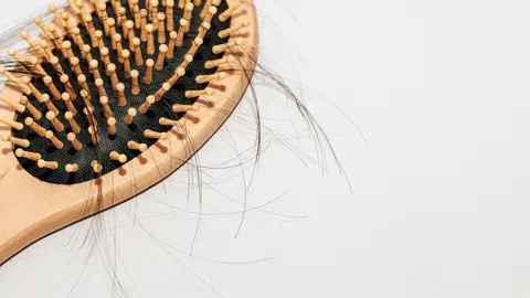 Una imagen a modo ilustrtivo. (WAM)