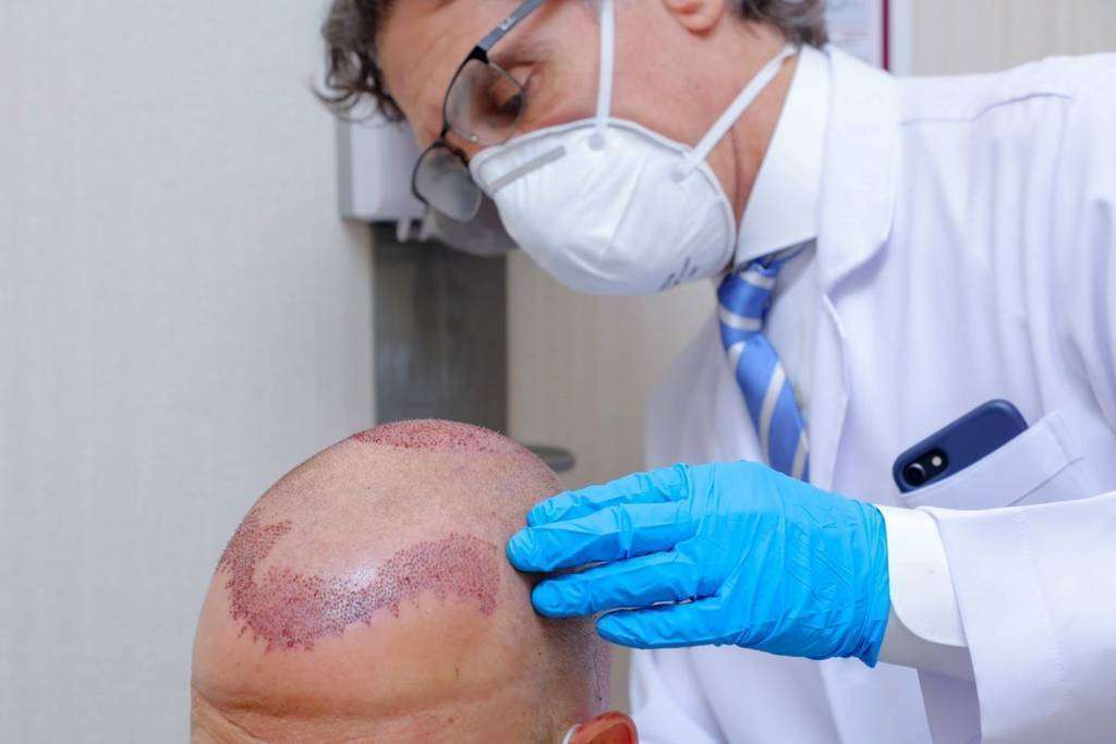 El doctor Bonesana prepara a un paciente para un trasplante de pelo. (EL CORREO)